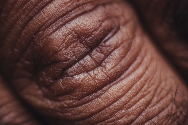 Early Detection Saves Lives: Why Regular Skin Cancer Screenings Matter